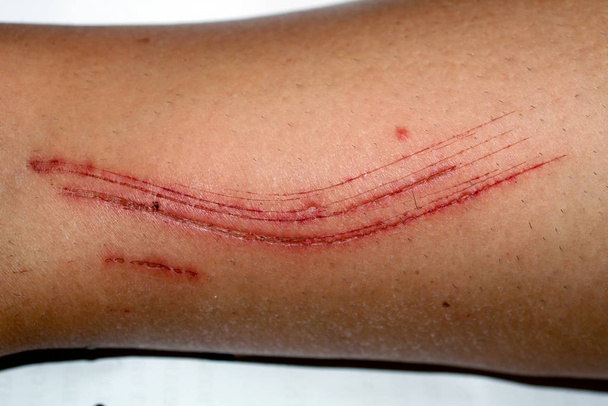 Large cut on the leg. Skin abrasion. - Photo, Image