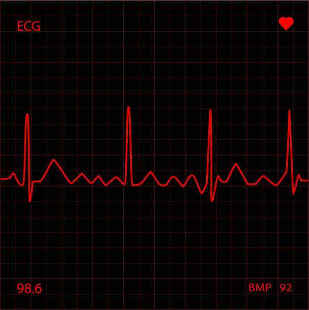 Monitor cardíaco
 - Vector, Imagen