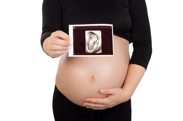 Nuori raskaana oleva nainen, jolla on kuva ultraäänitutkimuksesta
 - Valokuva, kuva