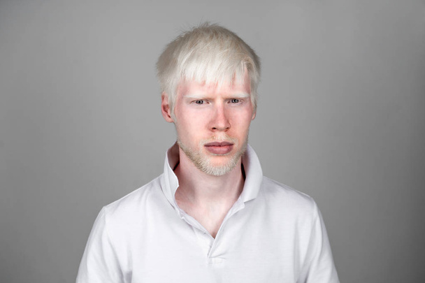 portrait of an albino man in  studio dressed t-shirt isolated on a white background. abnormal deviations. unusual appearance - Valokuva, kuva