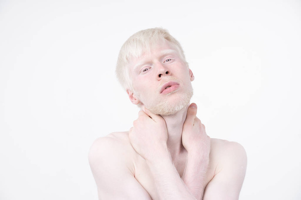 retrato de un hombre albino en estudio vestido camiseta aislada sobre un fondo blanco. desviaciones anormales. aspecto inusual
 - Foto, Imagen