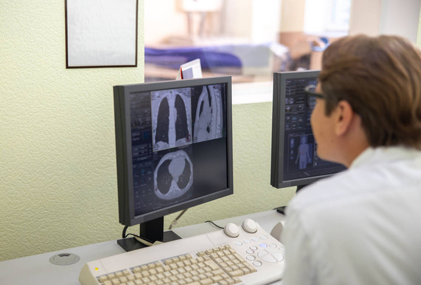 Lääkäri katselee monitorin kanssa rintakehän CT kuvia
 - Valokuva, kuva
