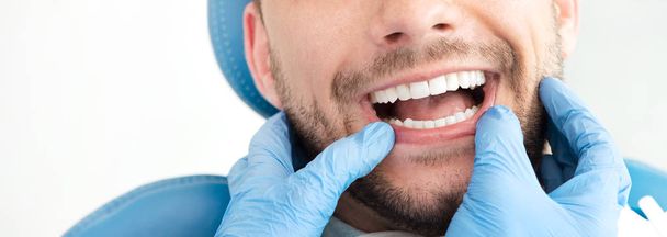 Man having teeth examined at dentists - Foto, afbeelding