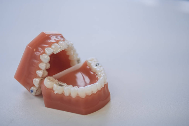 Um conjunto de dentaduras, clínica dentária
 - Foto, Imagem