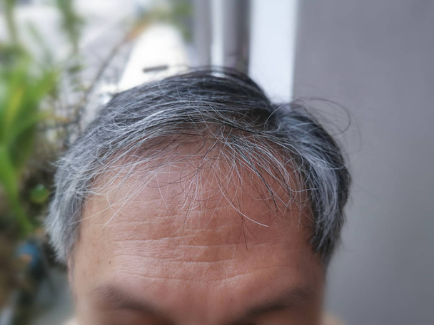forehead view of an elderly man - Фото, зображення