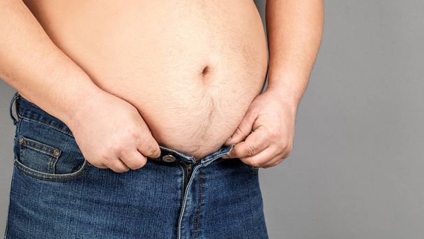 Una persona con sobrepeso no puede bajarse los pantalones por culpa del vientre.
  - Foto, imagen