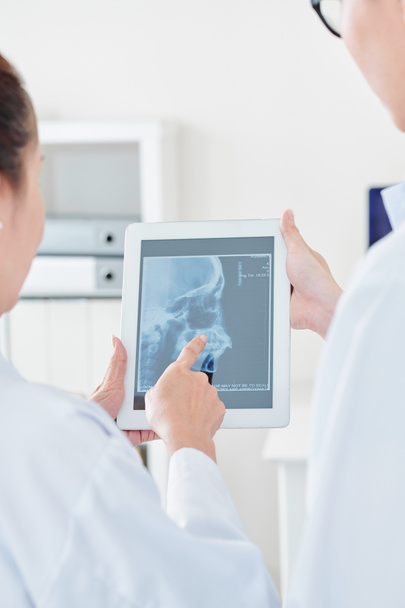 Surgeon pointing at jaw x-ray of patient on tablet computer when talking to coworker - Photo, Image
