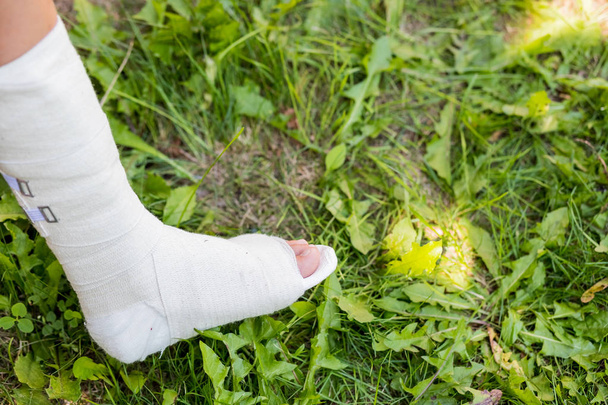 緑の草の上に子供の1つの白い石膏の脚。屋外でアクティブなゲーム。脚の石膏。事故の結果トランポリンの悪いジャンプ.安全規制の不遵守 - 写真・画像