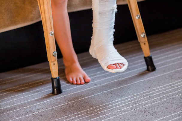 Gebroken been in cast van onherkenbaar klein kind. Jong meisje in orthopedische gegoten op krukken in huis. Kind met een gebroken been op krukken, enkelletsel. Botbreuk en enkelfractuur bij kinderen. - Foto, afbeelding