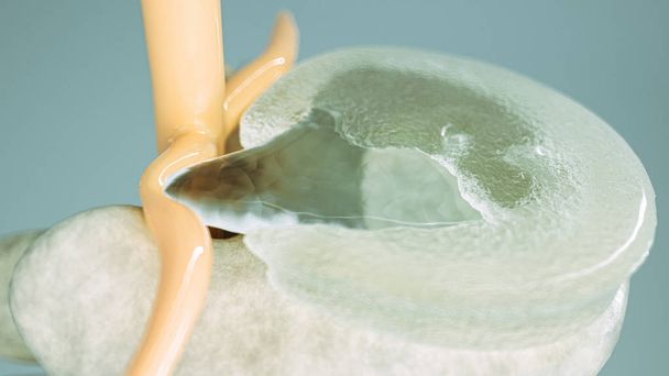 Spinale schijf hernia als close-up als 3D-rendering - Foto, afbeelding