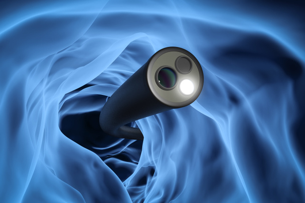 大腸内視鏡検査技術の概念  - 写真・画像