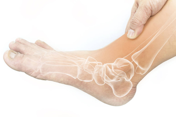 foot bones pain white background foot injury - Photo, Image