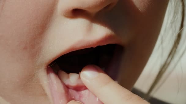 Chica tambaleándose suelto diente de bebé
 - Imágenes, Vídeo