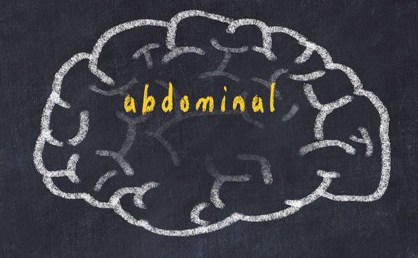 Drawind van menselijk brein op krijtbord met inscriptie abdominale - Foto, afbeelding