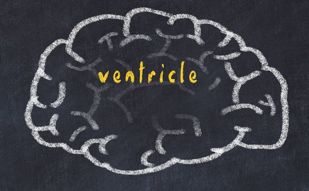 Drawind van menselijk brein op krijtbord met inscriptie ventrikel - Foto, afbeelding
