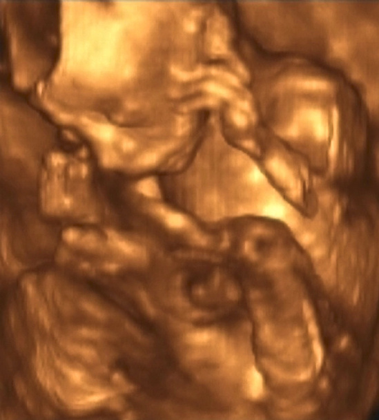 ανάλυση υπερηχογραφικό έλεγχο του εμβρύου 4ο μήνα - Φωτογραφία, εικόνα
