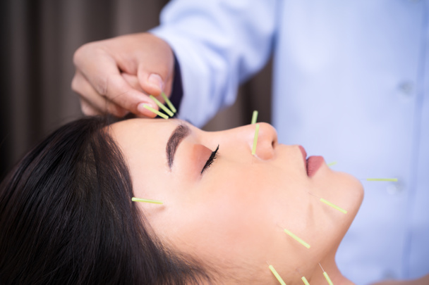 Kobieta poddawani leczeniu akupunktury na twarzy - Zdjęcie, obraz
