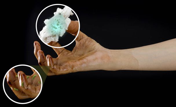 špinavá ruka s bakterie a bakteriemi - Fotografie, Obrázek