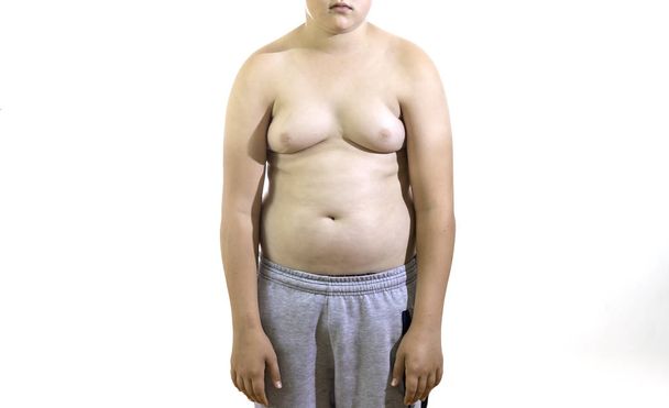 child fat body with folds on isolated white background - Foto, Imagem
