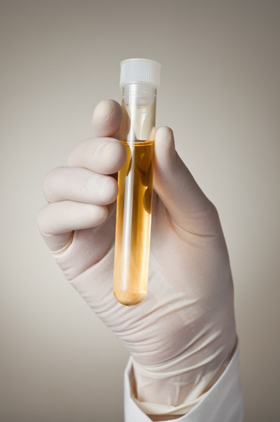 Mano del medico con campione di urina
 - Foto, immagini