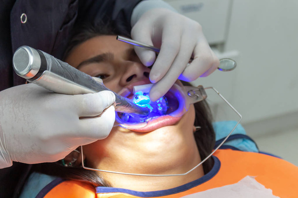 Zubař umísťujete na dospívající dívku ultrafialovým světlem - Fotografie, Obrázek