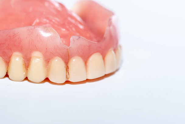 Old denture on a white background. - Photo, Image