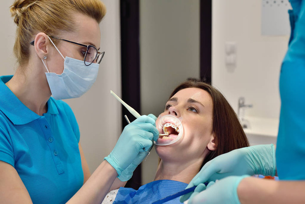 Dentist And Assistant Perform  Installation Procedure Of Bracket. Health Care Concept - Fotografie, Obrázek