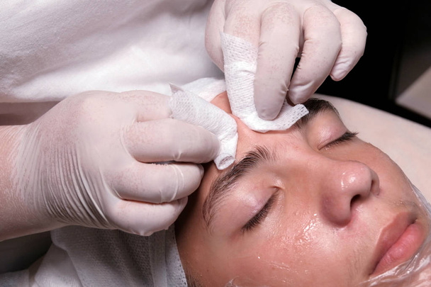 A beautician in white gloves squeezes acne on the boy's forehead. Dermatological teenage skin cleansing procedure. Men's hygiene and personal care. Teen guy at the cosmetology center. Close-up. - Photo, Image