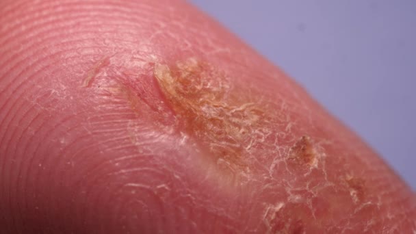 Az emberi bőr textúra közelről  - Felvétel, videó