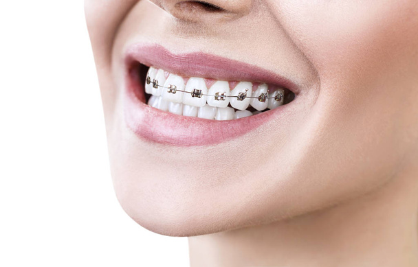 Mujer joven sonriendo con frenos en los dientes
. - Foto, imagen