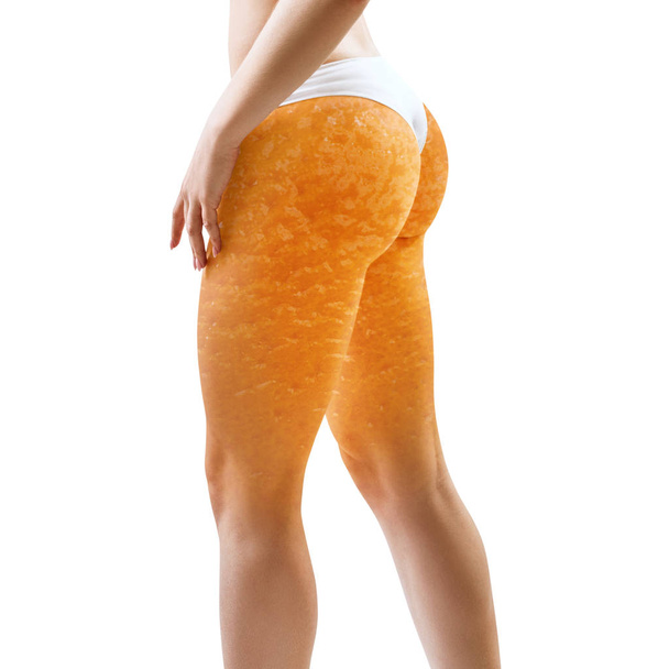 Kobiece pośladki z teksturą skórki pomarańczowej. - Zdjęcie, obraz