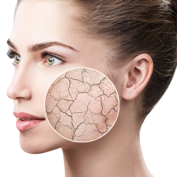 Zoom círculo muestra la piel facial seca antes de humedecer
. - Foto, Imagen