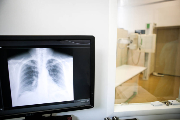 Detalhes com um raio-X torácico em um monitor de computador dentro de um cli
 - Foto, Imagem