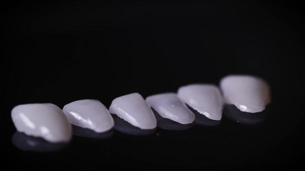 Makroaufnahmen von Veneers. Furniere sind spezielle Zahnbeläge, die eine ästhetische Funktion erfüllen. Moderne Präzisionsfertigung ermöglicht es Ihnen, das perfekte Lächeln zu erzeugen. - Filmmaterial, Video