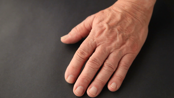 Senior Mans hand met een onvrijwillige beweging - Video