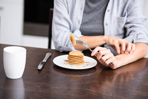 cropped view of woman scratching hand near sweet pancakes on plate - Photo, Image