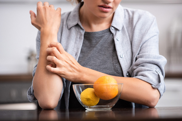 vista recortada de la mujer rascándose la mano cerca de tazón de vidrio con frutas
  - Foto, Imagen