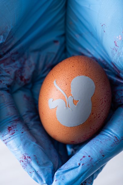vista recortada del médico en guantes de látex sosteniendo huevo con silueta de bebé
  - Foto, Imagen