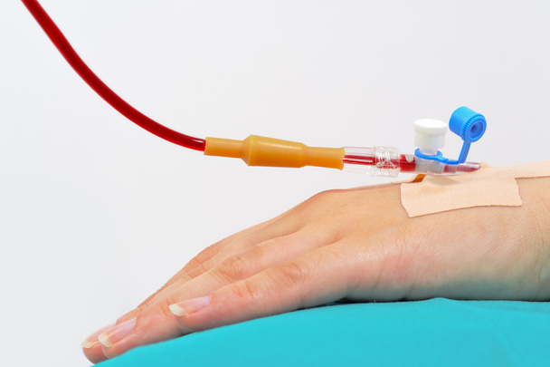 Transfusión de sangre - Foto, Imagen