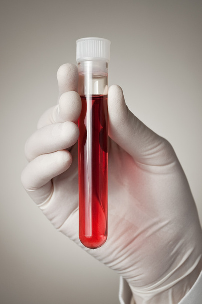 Doctor's hand with blood sample - Photo, Image