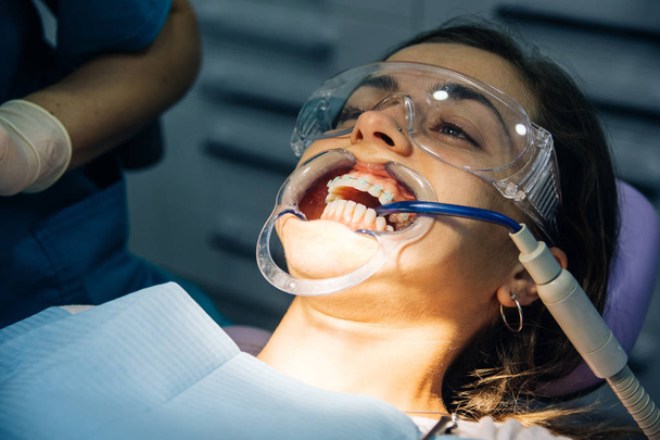 歯科医の女の子と歯科医院で白人の女の子に白い歯科ブレースを置くプロセス - 写真・画像