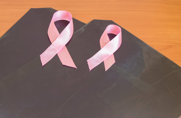 Des rayons X et deux rubans roses sont posés sur la table comme symbole de sensibilisation et de prévention du cancer du sein.
 - Photo, image