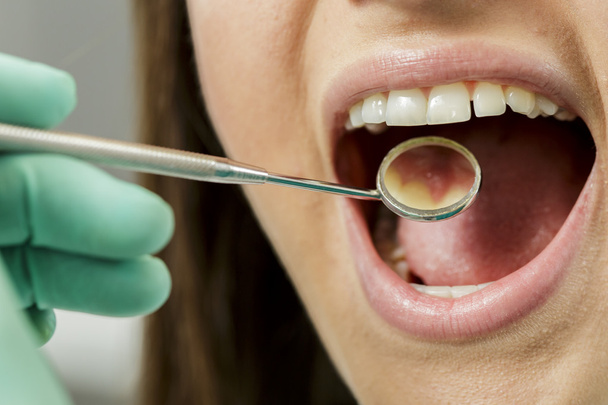 tandarts - Foto, afbeelding