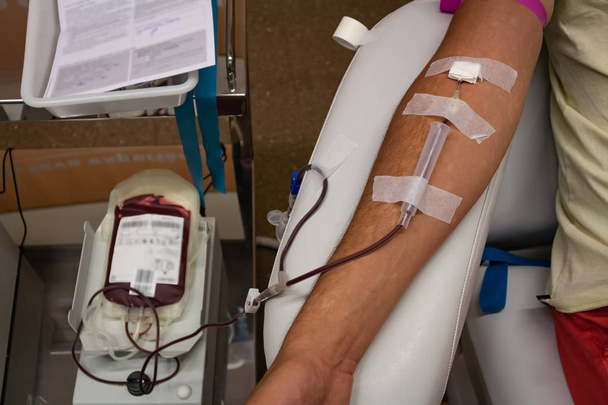 Doador de sangue doando sangue, um close-up do braço de um jovem enquanto o saco de sangue está enchendo, máquina de mistura de sangue no fundo
 - Foto, Imagem