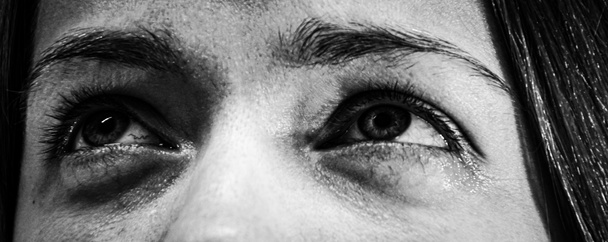 Tristes yeux gros plan noir et blanc photo, les femmes yeux avec des capillaires rouges et les rides sur un fond blanc
 - Photo, image