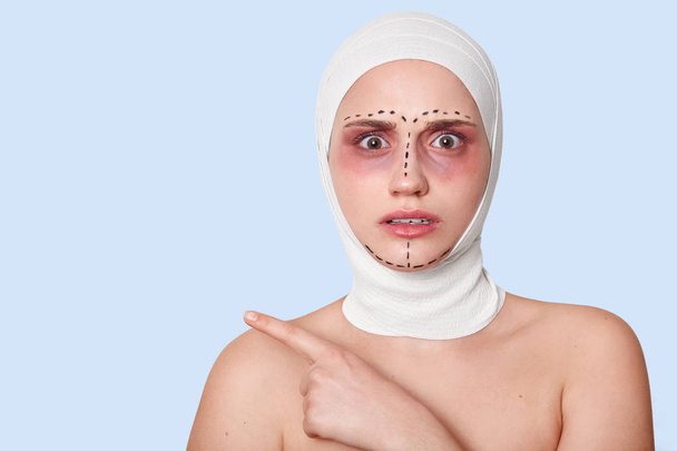 Young girl with bruises under eyes and wrapped in bandages, has arrows on face, shocked to hear unpleasent information about future operation, points aside with astonished and scared facial expression - 写真・画像