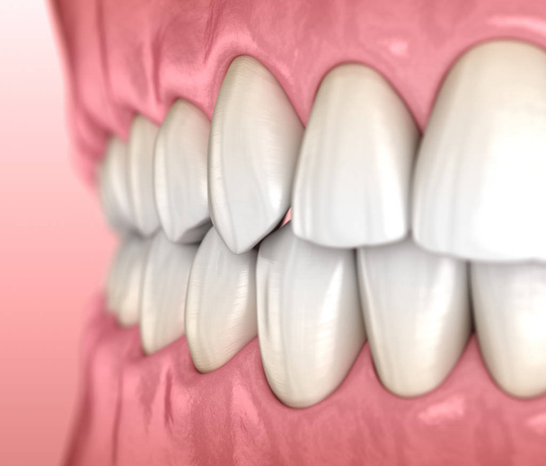 Gezonde menselijke tanden met normale occlusie, zijaanzicht. Medisch nauwkeurige tand 3D illustratie - Foto, afbeelding