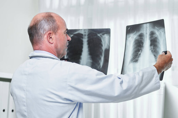 Medico generico che confronta due radiografie del torace del paziente con polmonite
 - Foto, immagini