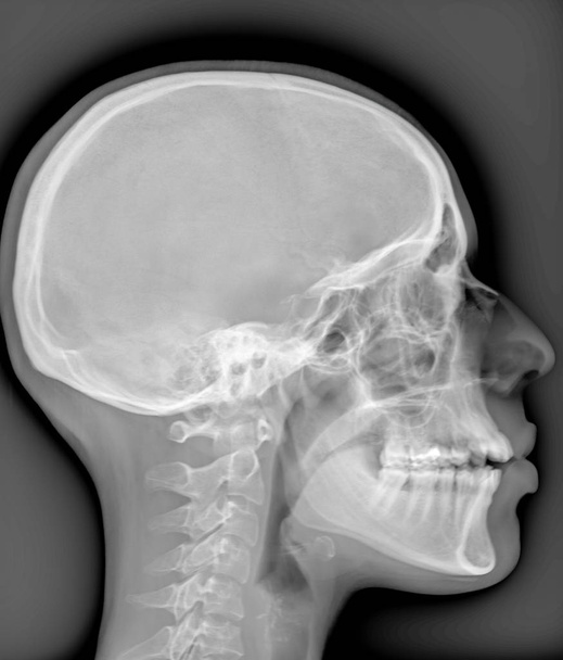 head x ray pictures