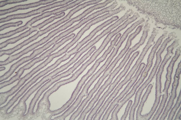 Coprinus-Pilz unter der Lupe - Foto, Bild